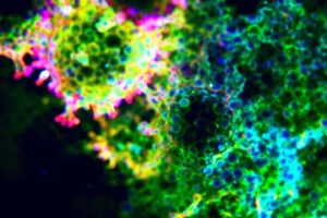 HPV 16 et 18 : dépistage, risques et conduite à tenir