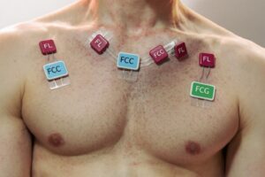 Position des électrodes ECG : guide complet et précis